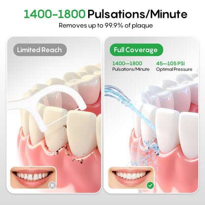 FRESKO Water Dental Flosser X6A